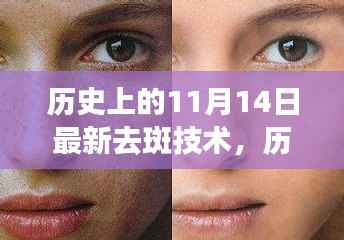 历史上的11月14日,最新去斑技术照亮人生,重塑自信与成就感之路