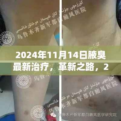 革新之路,2024年腋臭治疗新纪元探索最新疗法