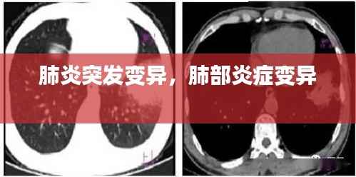 肺炎突发变异,肺部炎症变异